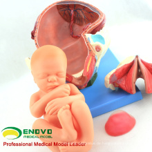 ANATOMY32 (12470) Anatomisches Modell zur Geburt des Menschen bei der Geburt besteht aus Gebärmutter, Fötus, Plazenta 12470